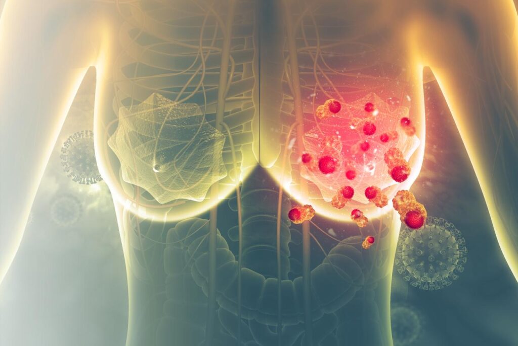 COMMENT GUERIR LE CANCER NATURELLEMENT ? WhatsApp : +229 682 607 03